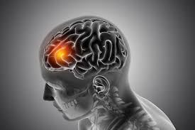 Neurological Disorder – 14N